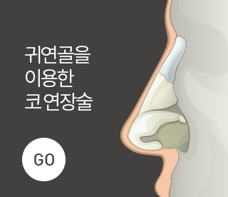 코연장